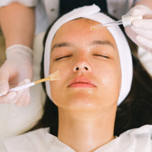 Advanced Chemical Peel